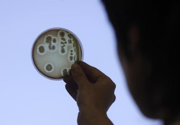 Specialist Jelena Kovalkova works to isolate the Escherichia coli (E.coli) bacteria strain in Riga